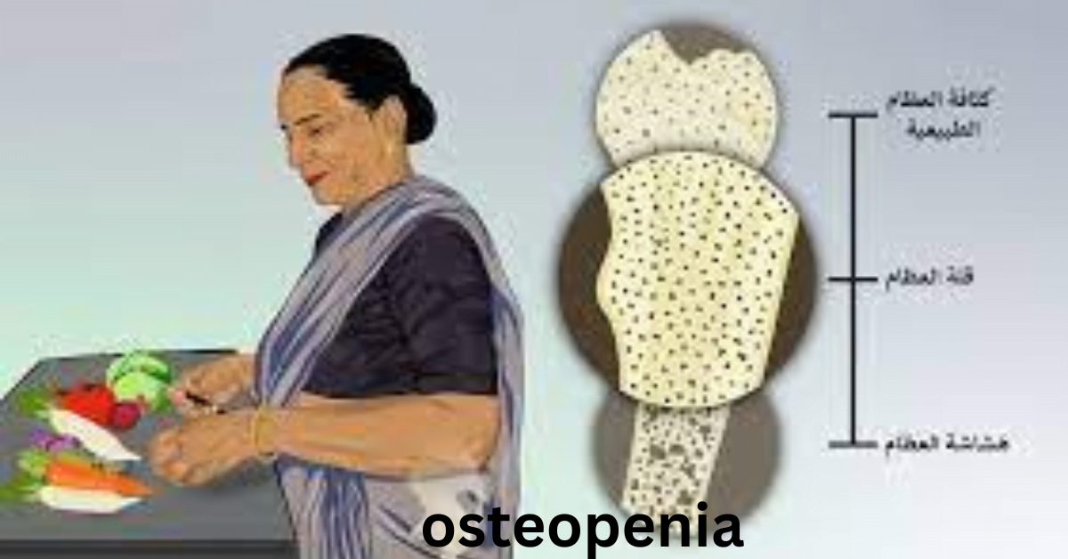 osteopenia